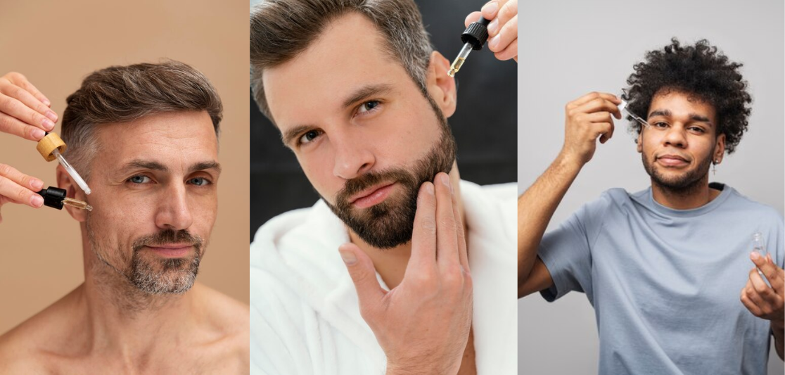 The 5 Early Signs of Male Pattern Baldness Most Men Ignore